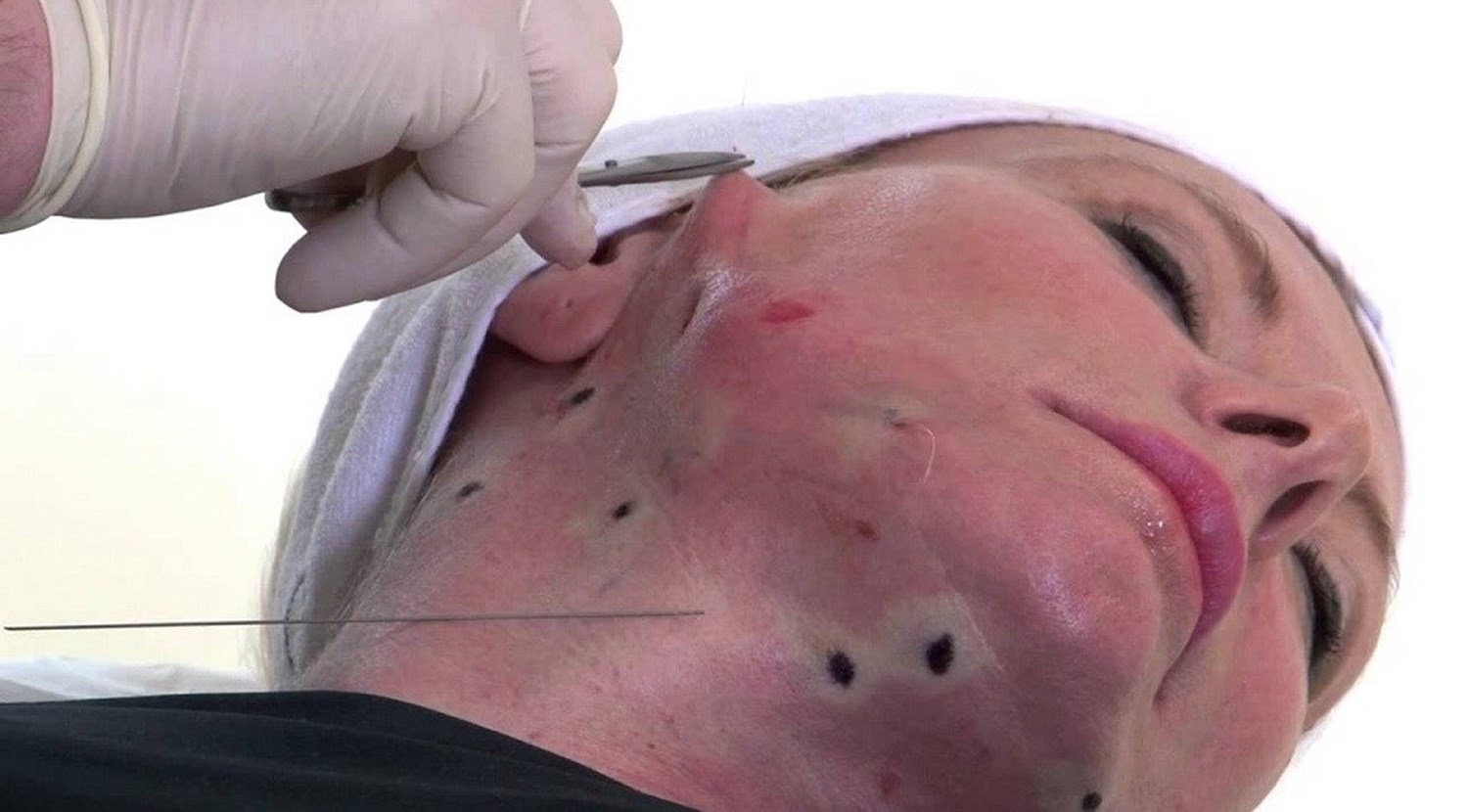 عمليات الوجه