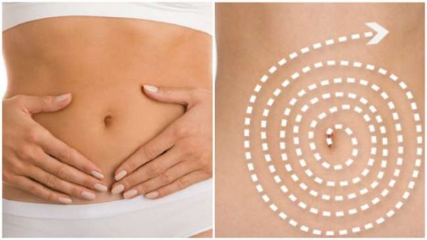ازالة ترهلات البطن بعد القيصرية