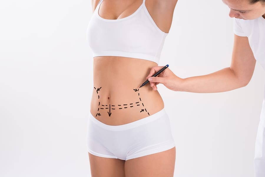 عمليات تجميل لشفط الدهون 