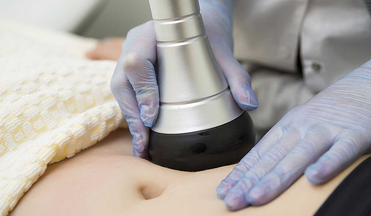 تفتيت الدهون بتقنية الفيزر 