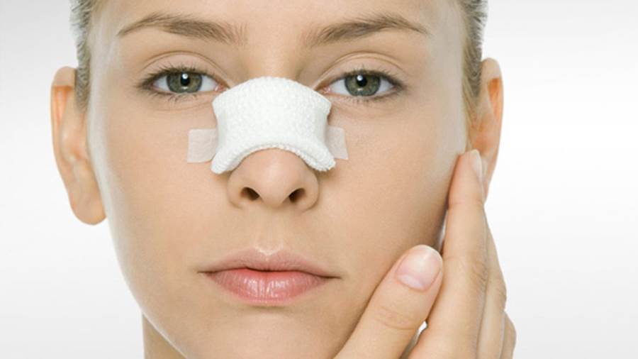 مراحل تغير الأنف بعد عملية التجميل