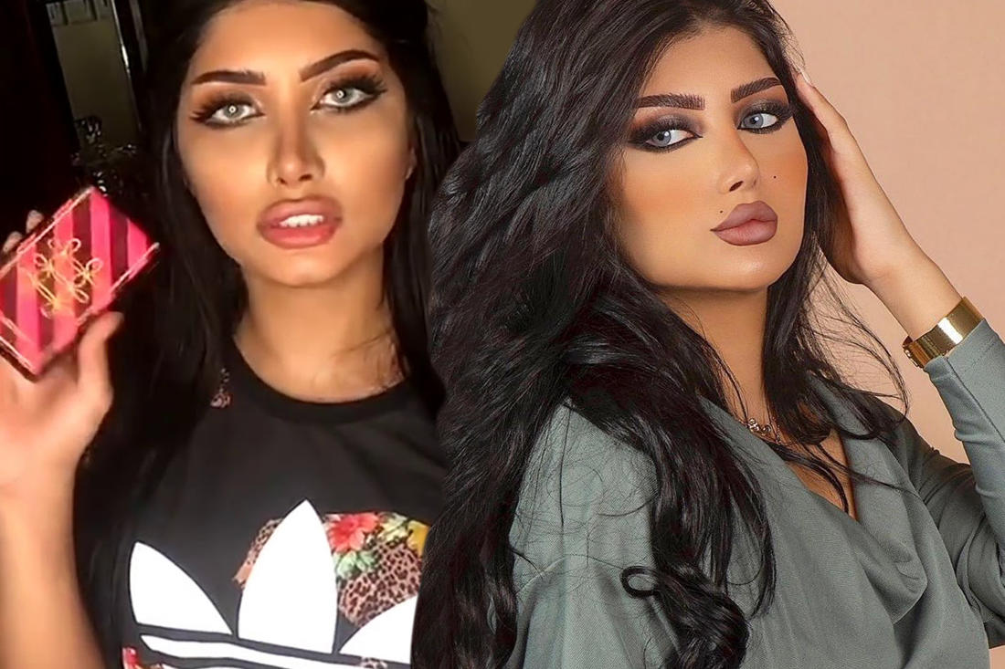ملكة كابلي قبل التجميل